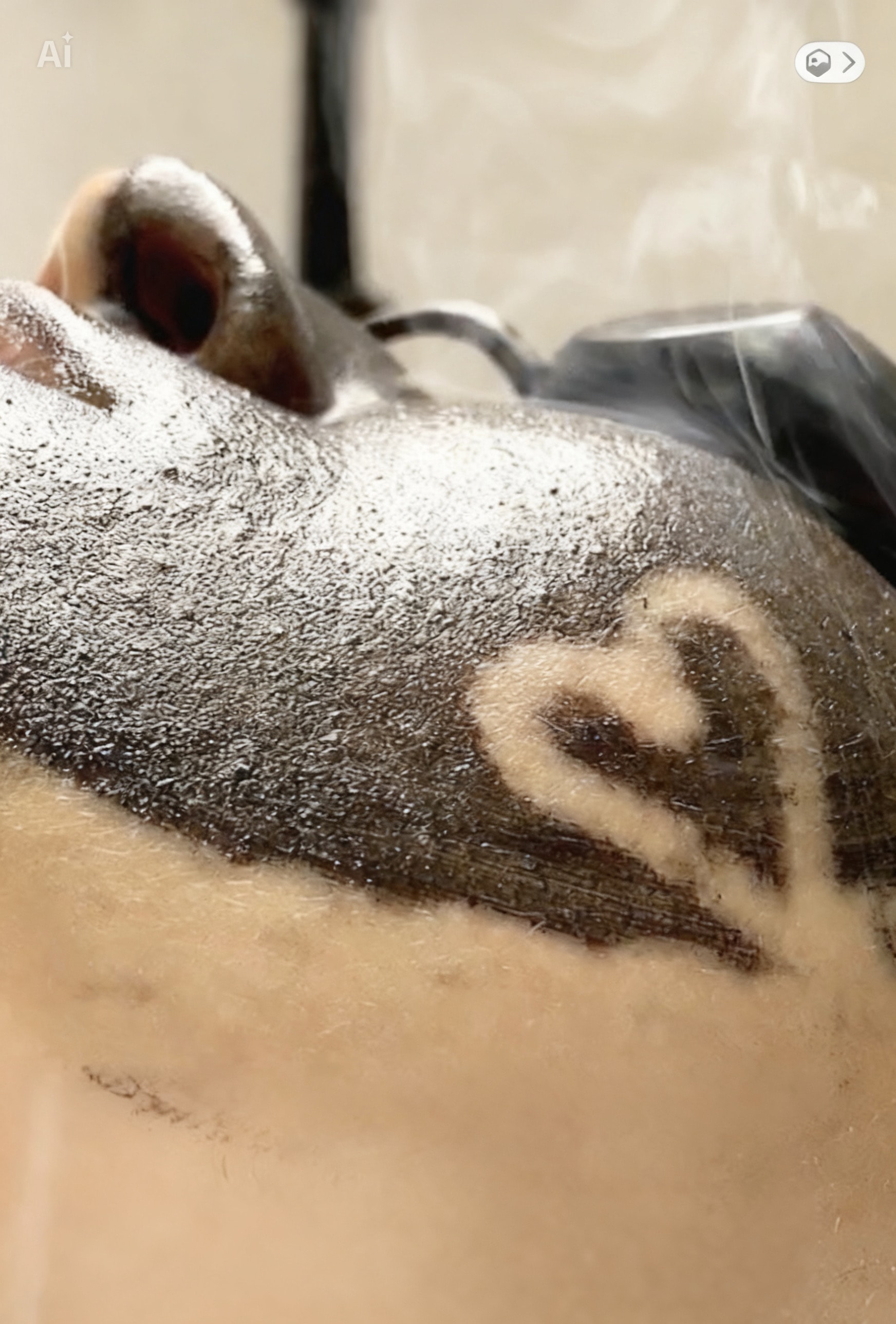 Carbon Peel Treatment